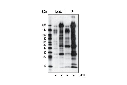 Immunoprecipitation Image 1: Phospho-Tyrosine (P-Tyr-1000) MultiMab<sup>®</sup> Rabbit Monoclonal Antibody mix