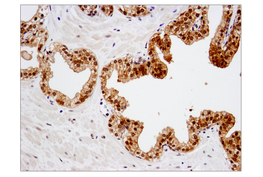 Immunohistochemistry Image 2: SMAD4 (D3R4N) Rabbit Monoclonal Antibody (BSA and Azide Free)