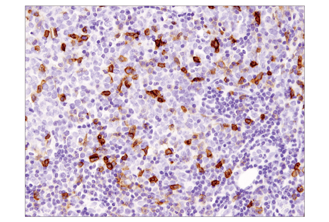 Immunohistochemistry Image 1: ICOS (D1K2T) Rabbit Monoclonal Antibody (BSA and Azide Free)