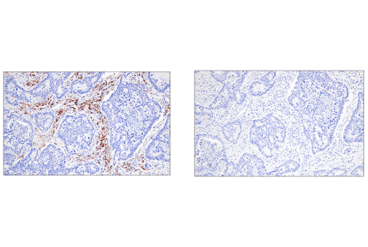 Immunohistochemistry Image 2: CRACC/SLAMF7/CD319 (E5C4M) Rabbit Monoclonal Antibody (BSA and Azide Free)