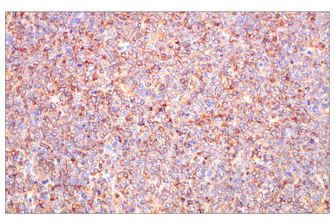 Immunohistochemistry Image 1: CD20 (E3N7O) Rabbit Monoclonal Antibody