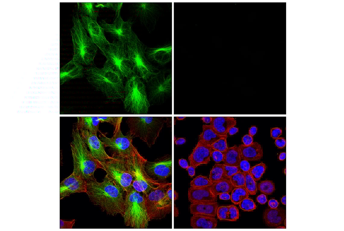 Immunofluorescence Image 1: beta3-Tubulin (E9F3E) Mouse Monoclonal Antibody (BSA and Azide Free)