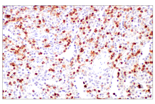 Immunohistochemistry Image 9: CD2 (D6V9F) Rabbit Monoclonal Antibody (BSA and Azide Free)