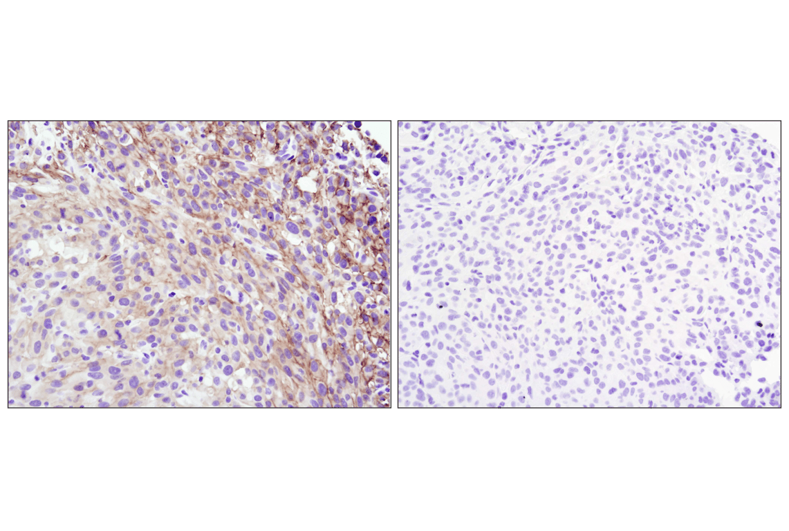 Immunohistochemistry Image 6: Phospho-Akt (Ser473) (D9E) XP<sup>®</sup> Rabbit mAb (BSA and Azide Free)