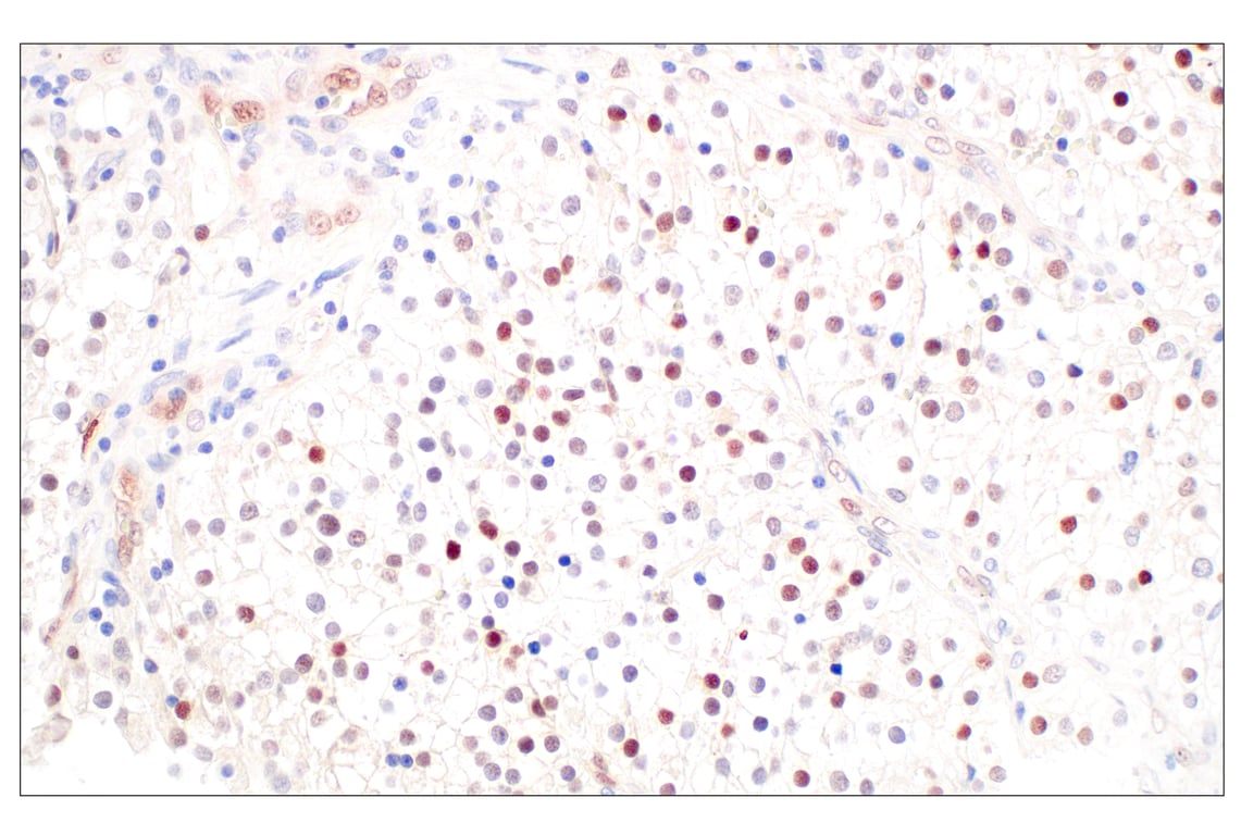 Immunohistochemistry Image 3: ARK5 (E4T2A) Rabbit Monoclonal Antibody