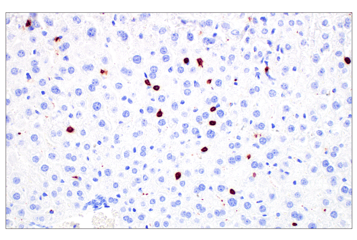 Immunohistochemistry Image 3: CD20 (E3N7O) Rabbit Monoclonal Antibody
