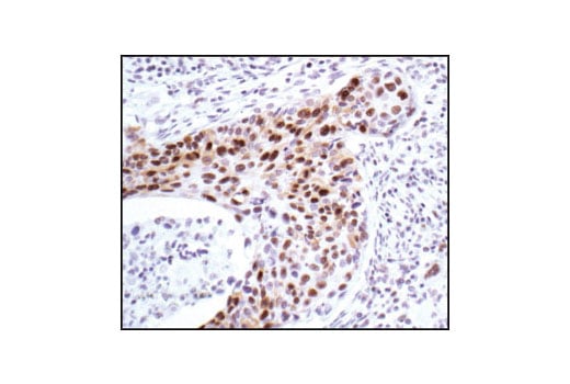Immunohistochemistry Image 3: Phospho-MAPK/CDK Substrates (PXS*P or S*PXR/K) (34B2) Rabbit Monoclonal Antibody