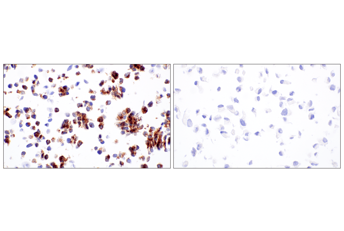Immunohistochemistry Image 7: DLK1 (F7O3Q) Rabbit Monoclonal Antibody