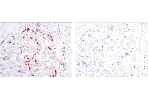 Immunohistochemistry Image 5: Phospho-S6 Ribosomal Protein (Ser240/244) (D68F8) Rabbit Monoclonal Antibody (BSA and Azide Free)