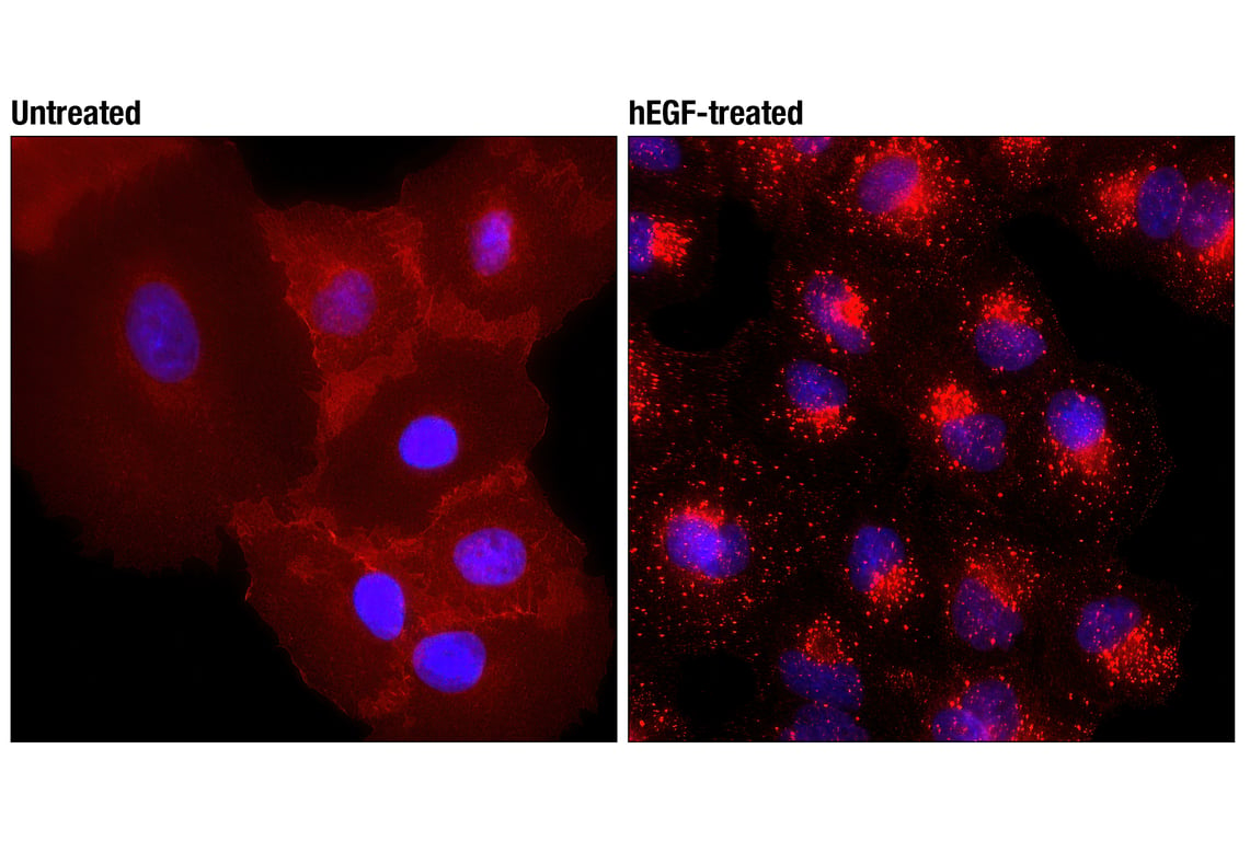 Immunofluorescence Image 1: EGF Receptor (D38B1) XP<sup>®</sup> Rabbit mAb (Alexa Fluor<sup>®</sup> 594 Conjugate)