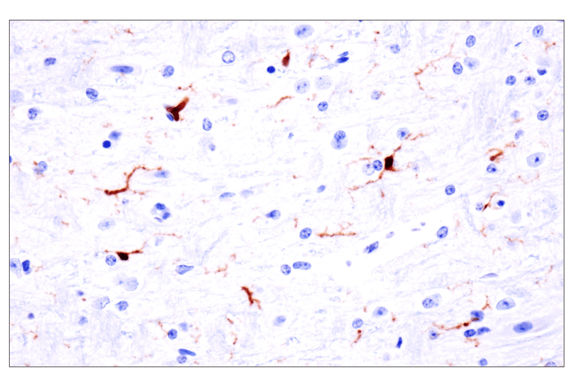 Immunohistochemistry Image 7: p47phox (F3Y6C) Rabbit Monoclonal Antibody (BSA and Azide Free)