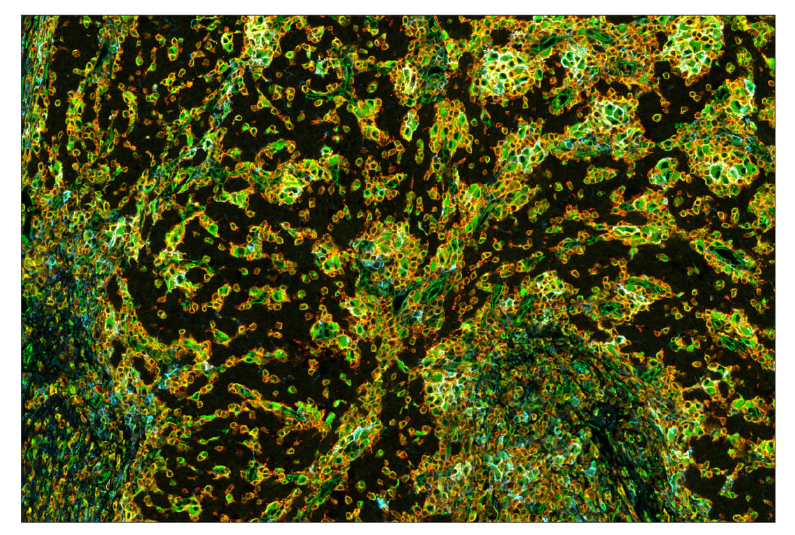 Immunohistochemistry Image 1: Vimentin (D21H3) & CO-0012-488 SignalStar<sup>™</sup> Oligo-Antibody Pair