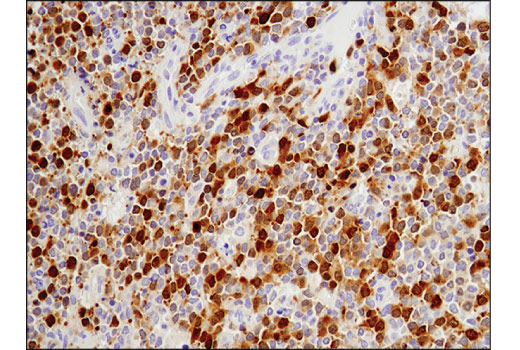 Immunohistochemistry Image 3: Aurora A (D3V7T) Rabbit Monoclonal Antibody (BSA and Azide Free)