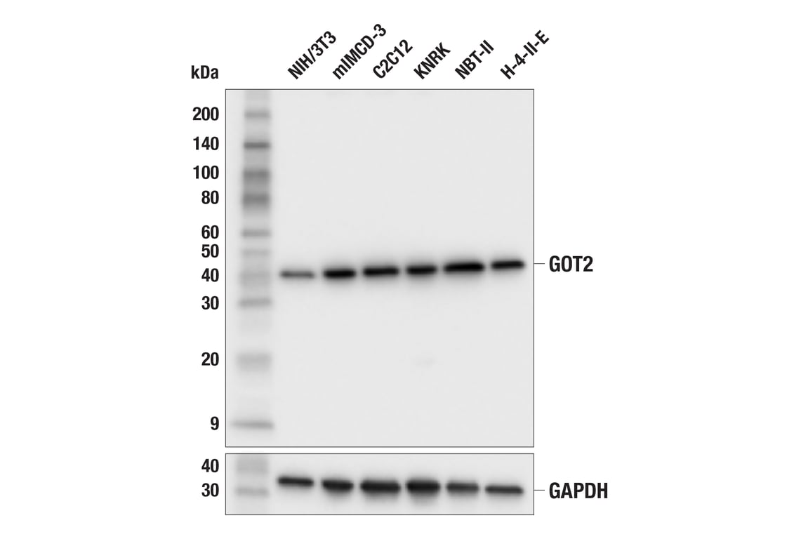 Western Blotting Image 2: GOT2 (F4P3R) Rabbit Monoclonal Antibody (BSA and Azide Free)