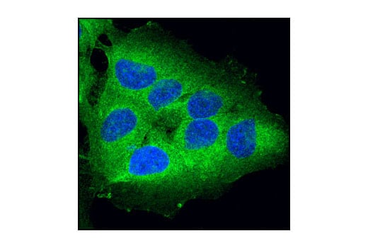 Immunofluorescence Image 1: RIP (D94C12) Rabbit Monoclonal Antibody (BSA and Azide Free)