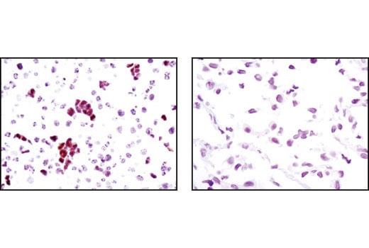 Immunohistochemistry Image 1: Sox2 (C70B1) Rabbit Monoclonal Antibody