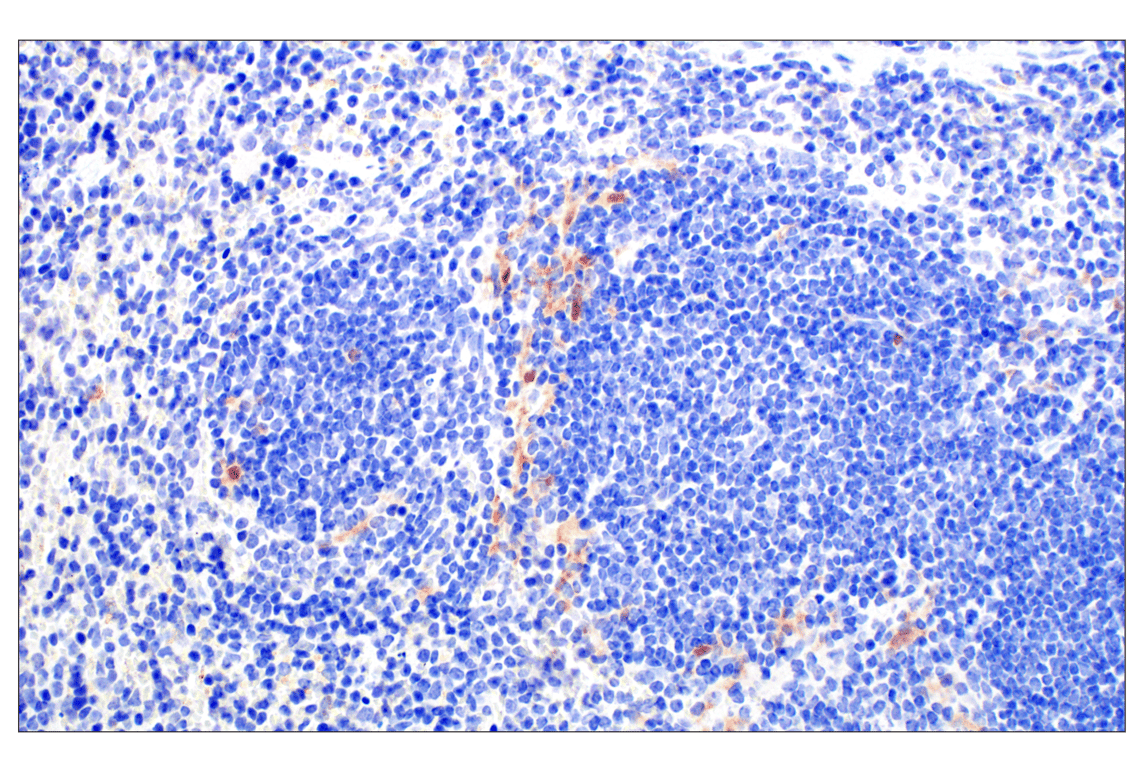 Immunohistochemistry Image 4: p16 INK4A (F2T7H) Rabbit Monoclonal Antibody