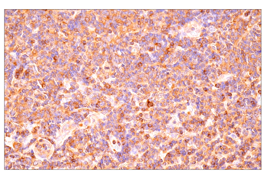 Immunohistochemistry Image 3: NF-kappaB1 p105/p50 (D7H5M) Rabbit Monoclonal Antibody (BSA and Azide Free)