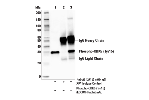 Immunoprecipitation Image 1: Phospho-CDK5 (Tyr15) (E6C8N) Rabbit Monoclonal Antibody
