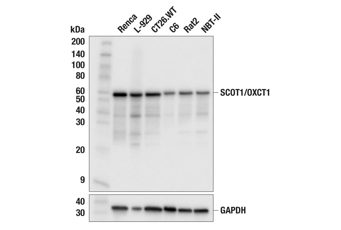 Western Blotting Image 2: SCOT1/OXCT1 (F1O1D) Rabbit Monoclonal Antibody