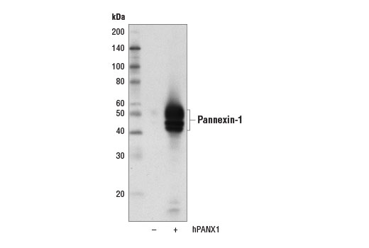 Western Blotting Image 2: Pannexin-1 (D9M1C) Rabbit Monoclonal Antibody