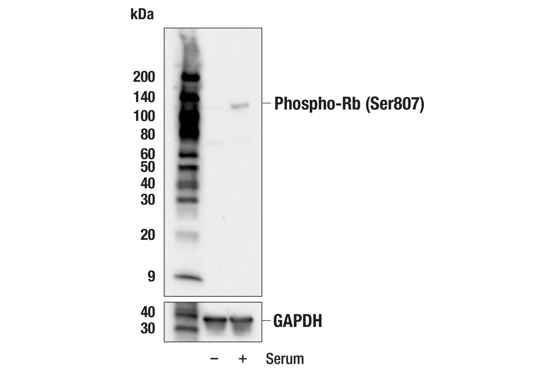 Western Blotting Image 2: Phospho-Rb (Ser807) (E8X7B) Rabbit Monoclonal Antibody
