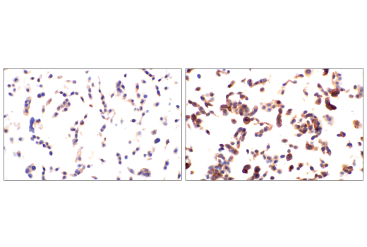 Immunohistochemistry Image 6: Phospho-Tyrosine Mouse Monoclonal Antibody (P-Tyr-100)