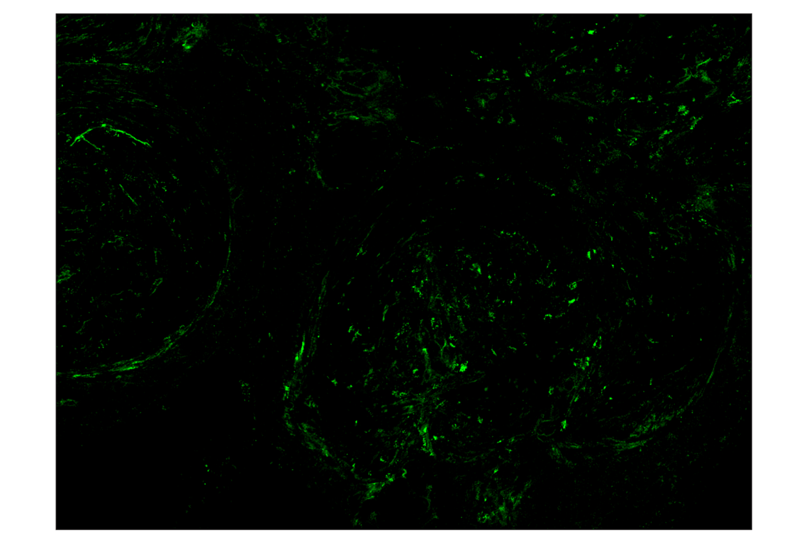 Immunohistochemistry Image 2: NT5E/CD73 (D7F9A) & CO-0039-594 SignalStar<sup>™</sup> Oligo-Antibody Pair
