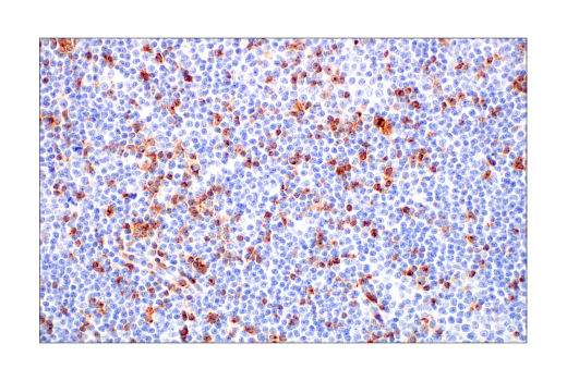 Immunohistochemistry Image 1: CD2 (D6V9F) Rabbit Monoclonal Antibody (BSA and Azide Free)