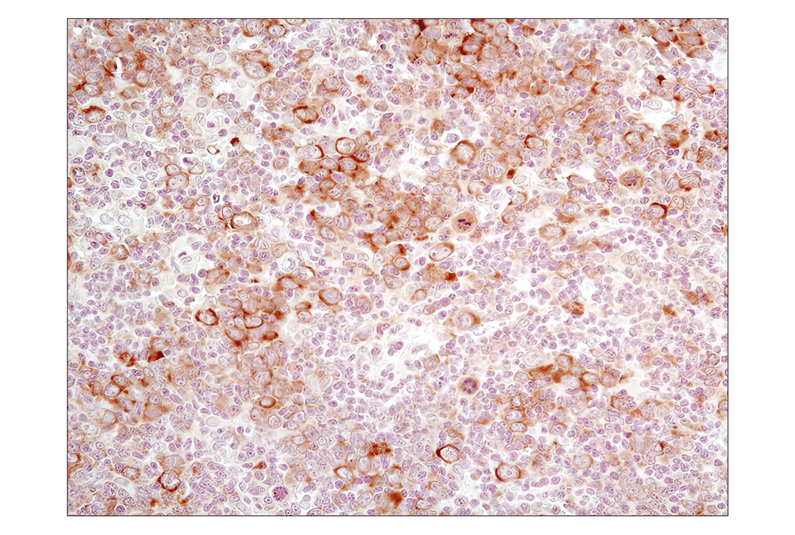 Immunohistochemistry Image 3: Phospho-eIF2 alpha (Ser51) (D9G8) Rabbit Monoclonal Antibody (BSA and Azide Free)