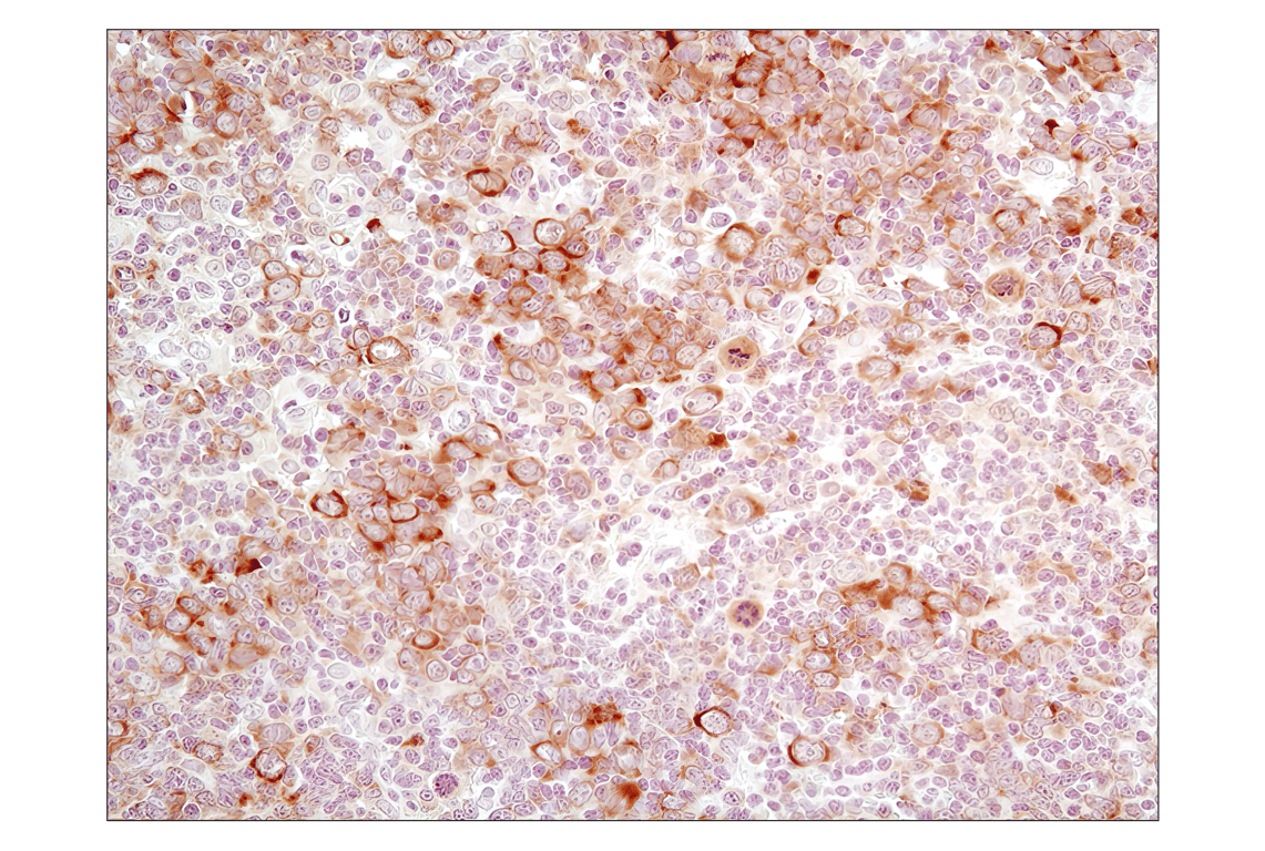 Immunohistochemistry Image 3: Phospho-eIF2α (Ser51) (D9G8) XP<sup>®</sup> Rabbit mAb (BSA and Azide Free)