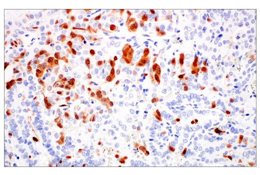 Immunohistochemistry Image 1: p16 INK4A (BC42) Mouse Monoclonal Antibody
