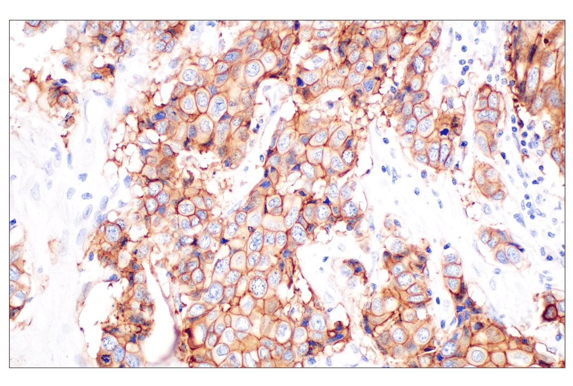 Immunohistochemistry Image 2: TACSTD2/TROP2 (F4W4J) Rabbit Monoclonal Antibody (BSA and Azide Free)