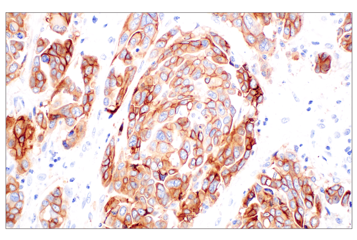 Immunohistochemistry Image 4: TACSTD2/TROP2 (F4W4J) Rabbit Monoclonal Antibody