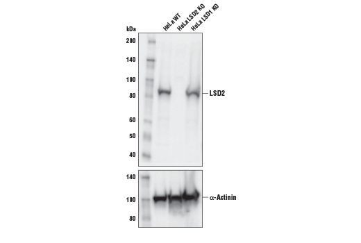 Western Blotting Image 2: LSD2 (E1R6O) Rabbit Monoclonal Antibody