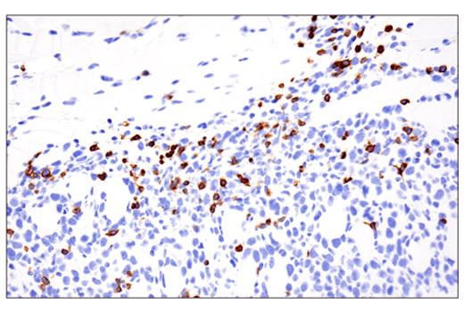 Immunohistochemistry Image 1: CD3 epsilon (E4T1B) Rabbit Monoclonal Antibody