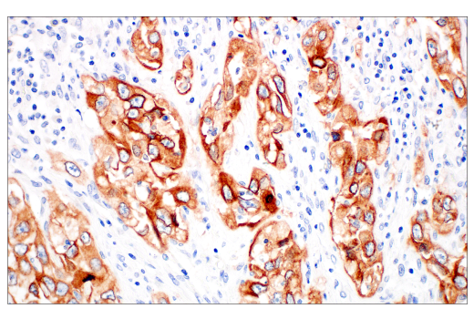 Immunohistochemistry Image 2: Integrin beta6 (E4M9P) Rabbit Monoclonal Antibody