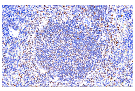 Immunohistochemistry Image 1: RUNX3/AML2 (D6E2) Rabbit Monoclonal Antibody