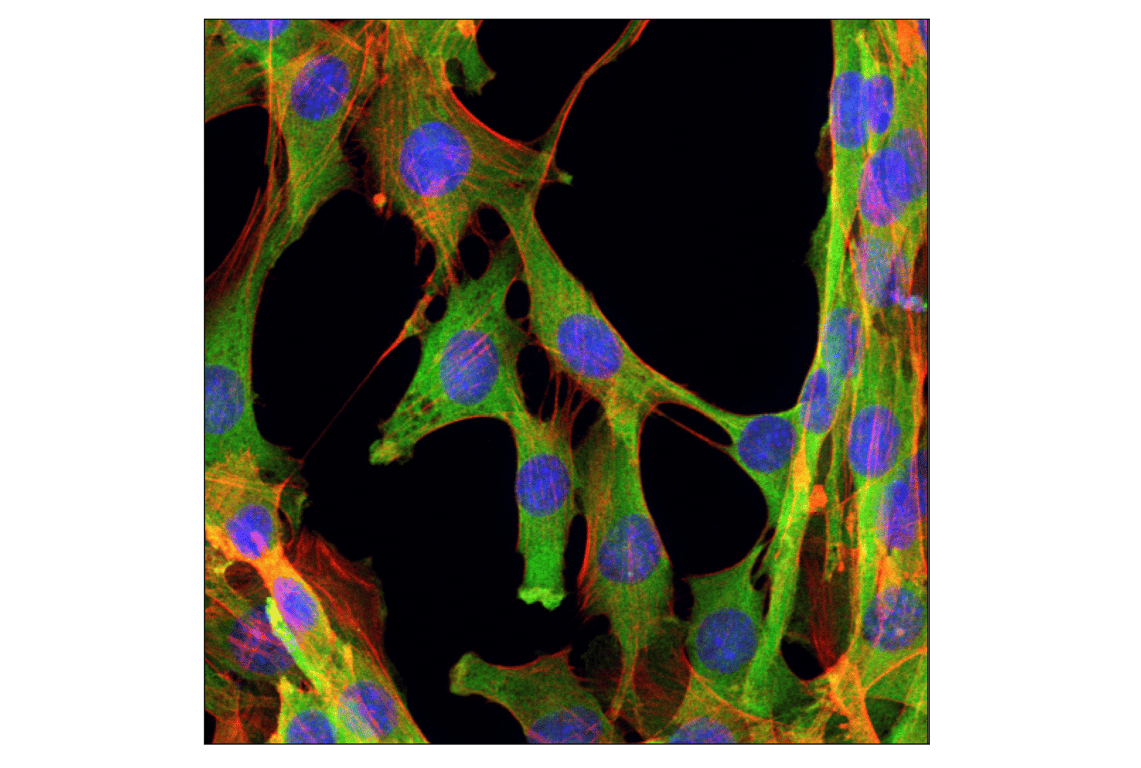 Immunofluorescence Image 1: GAPDH (D16H11) Rabbit Monoclonal Antibody