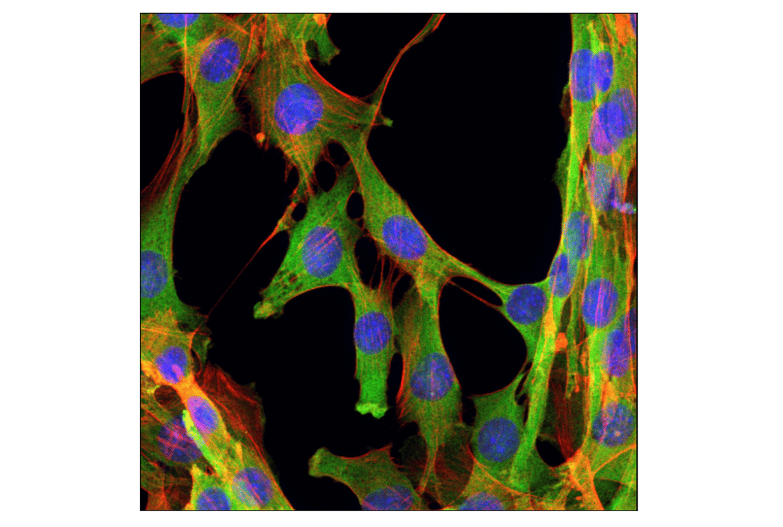 Immunofluorescence Image 1: GAPDH (D16H11) XP<sup>®</sup> Rabbit mAb