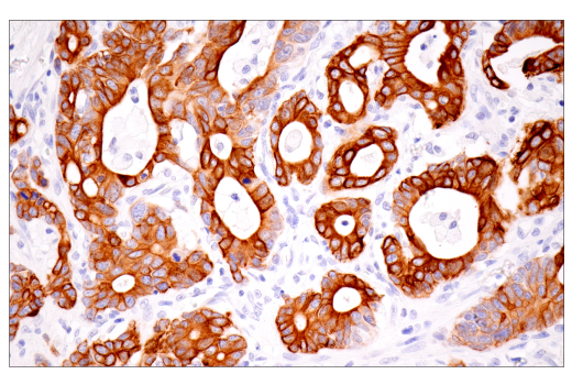 Immunohistochemistry Image 1: Keratin 7 (RN7) Mouse Monoclonal Antibody