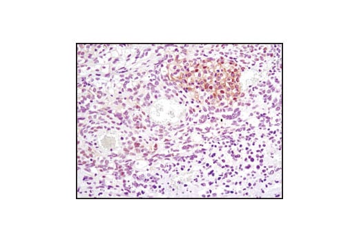 Immunohistochemistry Image 3: FoxO1 (C29H4) Rabbit Monoclonal Antibody (BSA and Azide Free)