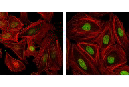 Immunofluorescence Image 1: FoxM1 (D12D5) Rabbit Monoclonal Antibody
