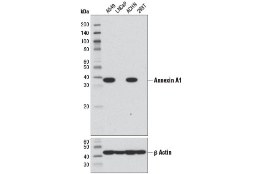 Western Blotting Image 1: Annexin A1 (D5V2T) XP<sup>®</sup> Rabbit mAb