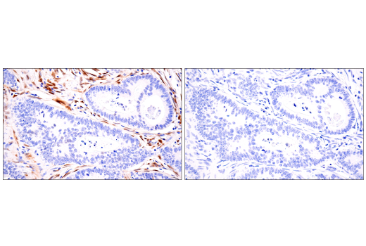 Immunohistochemistry Image 7: TAZ (E9J5A) Rabbit Monoclonal Antibody (BSA and Azide Free)