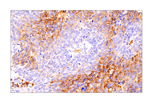 Immunohistochemistry Image 6: Glut1 (IHC404) Mouse Monoclonal Antibody