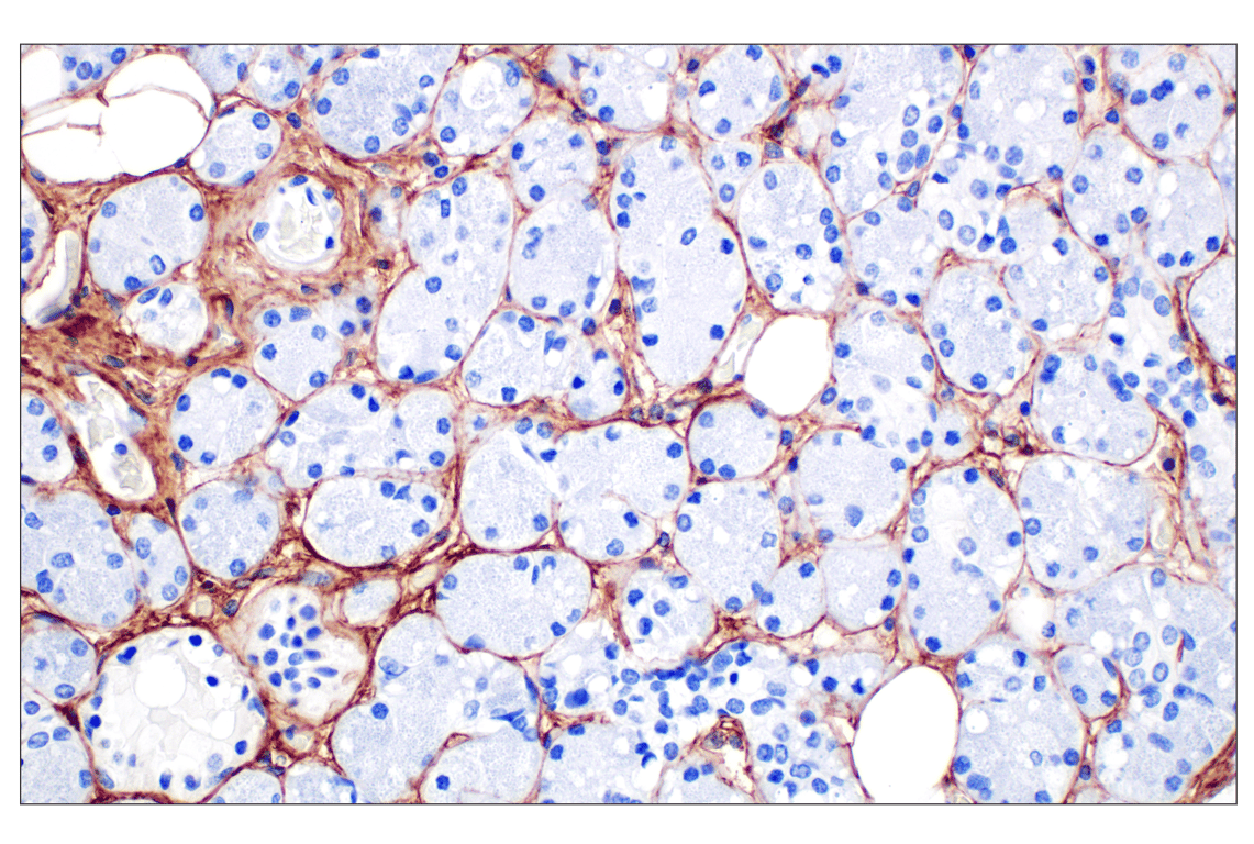 Immunohistochemistry Image 2: COL6A1 (E9U3B) Rabbit Monoclonal Antibody (BSA and Azide Free)