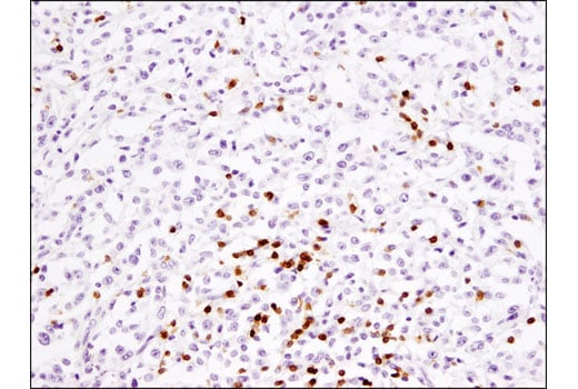 Immunohistochemistry Image 3: CD3 epsilon (D7A6E) Rabbit Monoclonal Antibody