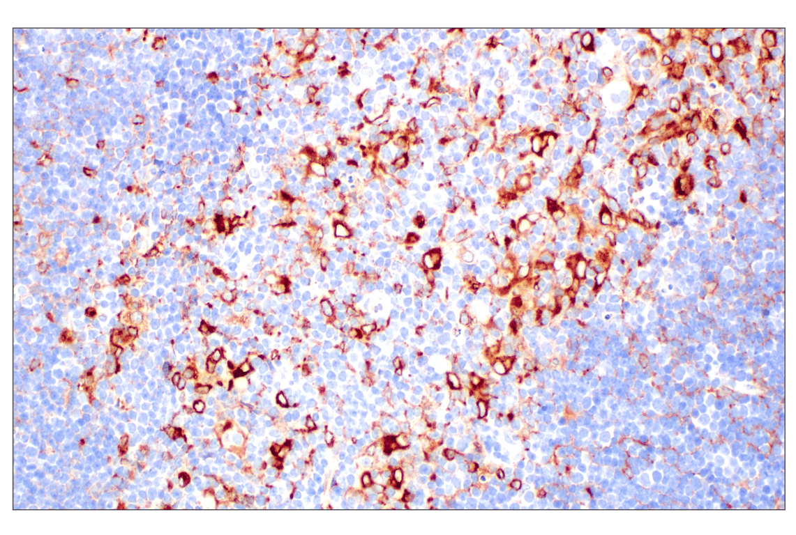 Immunohistochemistry Image 6: CD74 (F3R3L) Rabbit Monoclonal Antibody