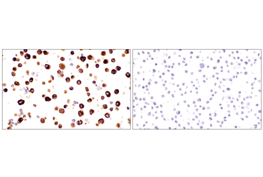 Immunohistochemistry Image 6: IgM (E9U8J) Rabbit Monoclonal Antibody